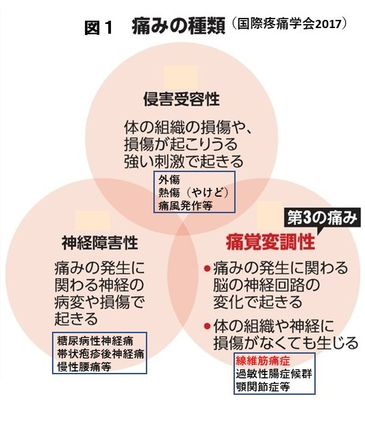 線維筋痛症 Fm 公益財団法人日本リウマチ財団