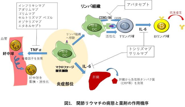 関節リウマチの病態と薬剤の作用機序